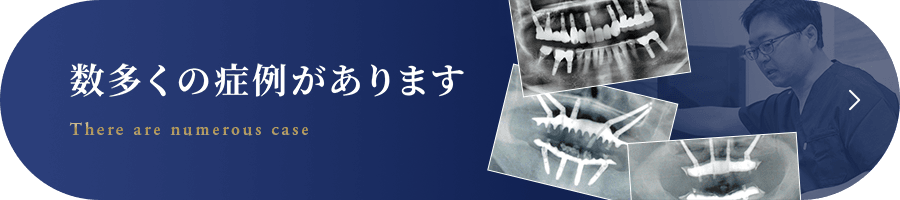 数多くの症例がありますバナー