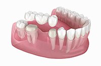 ブリッジ イメージ