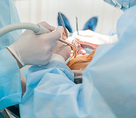 治療の流れ イメージ5