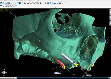 医療法人ファイブエスの歯科医師が信頼される理由 イメージ4